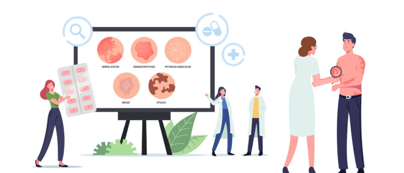 帯状疱疹に生命保険はおりる？帯状疱疹に備えらえる保険の種類や通院・入院保障について解説