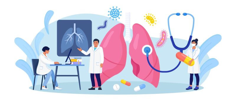 肺がんを治療する抗がん剤はどれ？肺がんの治療で使う抗がん剤の特徴や副作用を解説